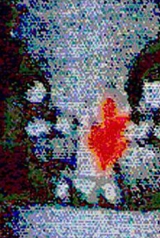 105fdb32eea49b9bd09afd1ba2d224b8_160_238